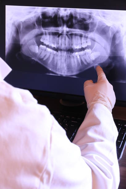 Best Dentist for Tooth Abscess  in Hlsboro, IL